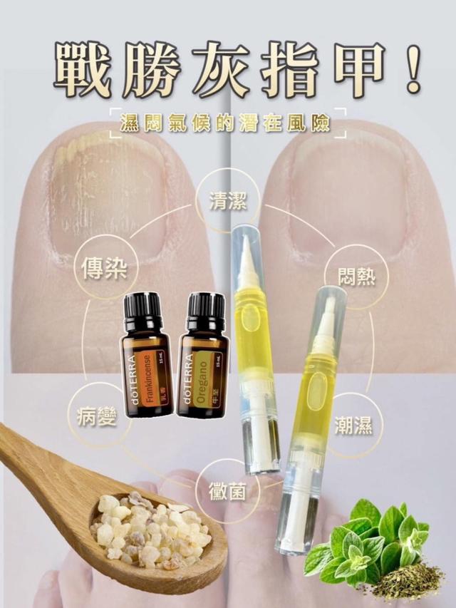 多特瑞doTERRA 灰指甲特調精油筆3mL -3/3下午3點收單