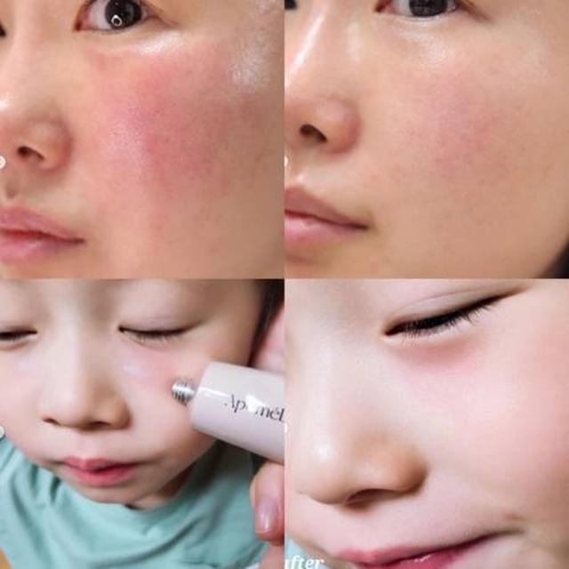 韓國 ApomeDerm萬用神霜2.0-升級版 50ml#01/01
