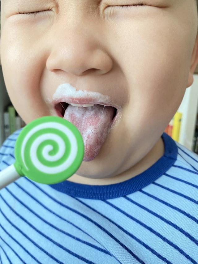 韓國Edison 愛迪生 棒棒糖舌苔牙刷 舌苔清潔器#12/07