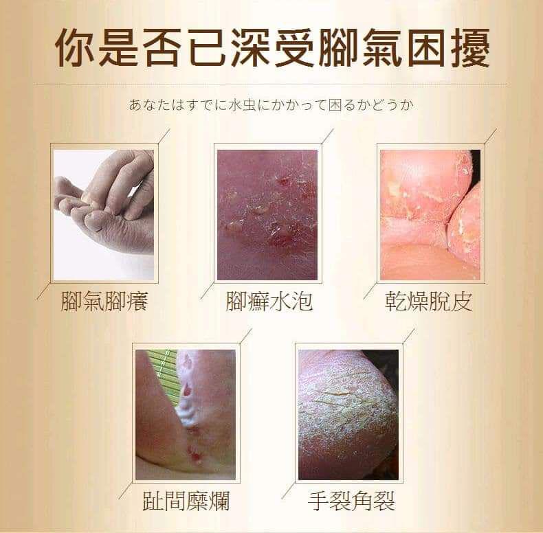 預購s 馬油腳氣舒緩修護潤澤防龜裂霜 愛批發 美妝保養批發團購零售買賣貨源網 預購s 馬油腳氣舒緩修護潤澤防龜裂霜 愛批發 美妝保養批發團購零售買賣貨源網
